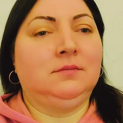 Erika, Székelyudvarhely