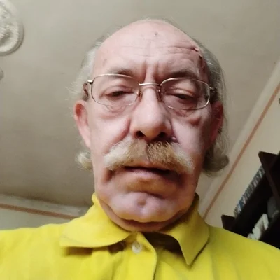 István